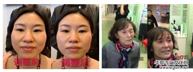 ���t(y��)�þ��ַ������ˡ�������ة