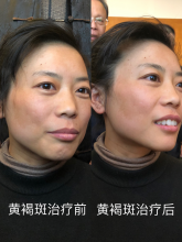 ���t(y��)�þ��ַ������ˡ�������ة